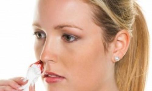 Почему постоянно идет кровь из носа: причины, возможные проблемы, диагностика и лечение